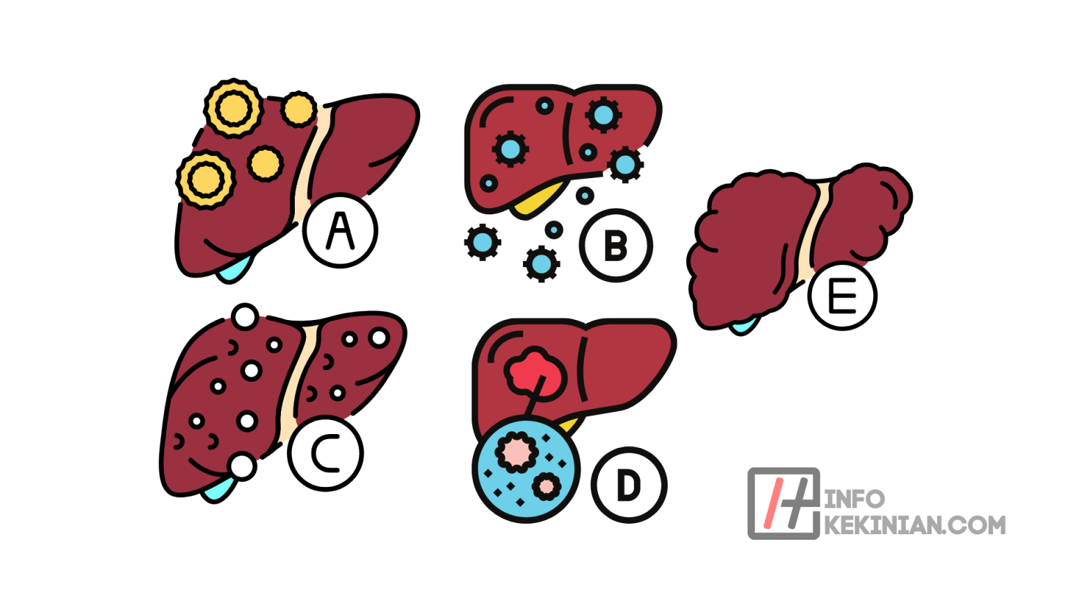 Perbedaan Hepatitis A, B, C, D, Dan E