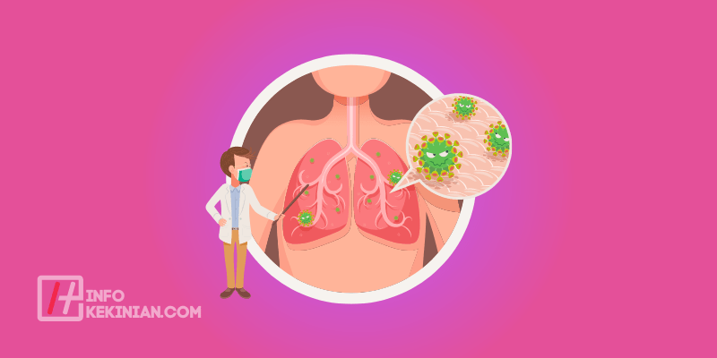 Pneumonia