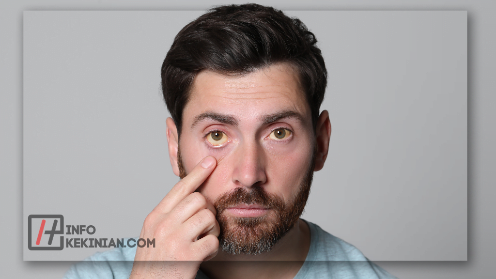 Gangguan yang Terjadi pada Mata