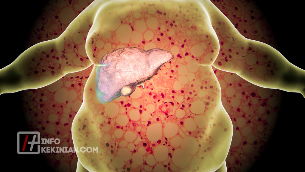 Pengertian Metabolisme: Proses, Jenis, Fungsi dan Faktornya yang Wajib Diketahui! 3 Fungsi Metabolisme