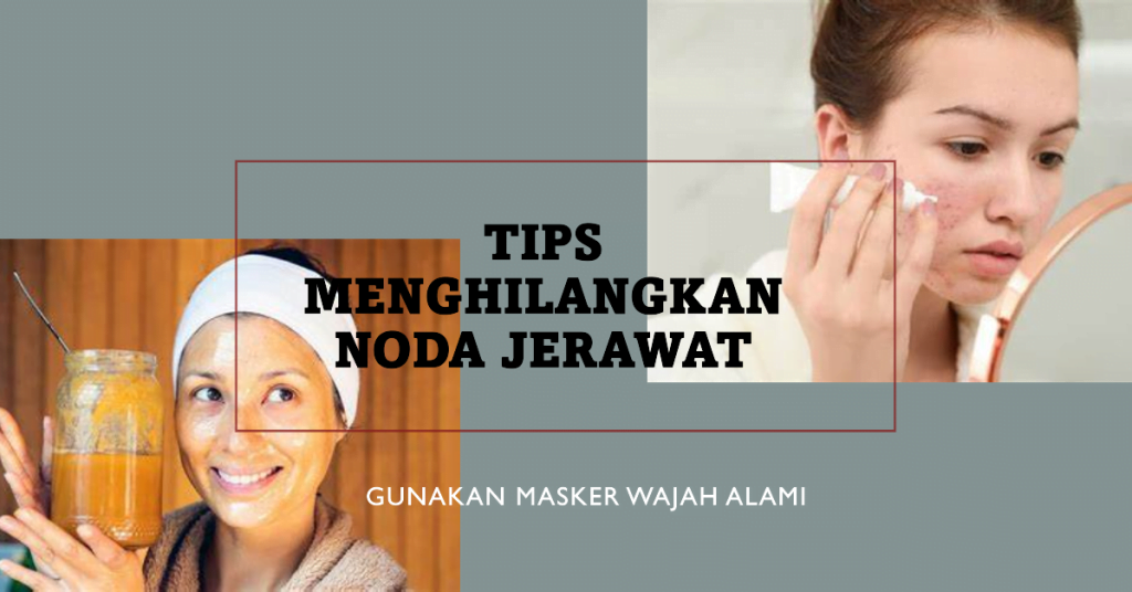 Tips Menghilangkan Noda Jerawat