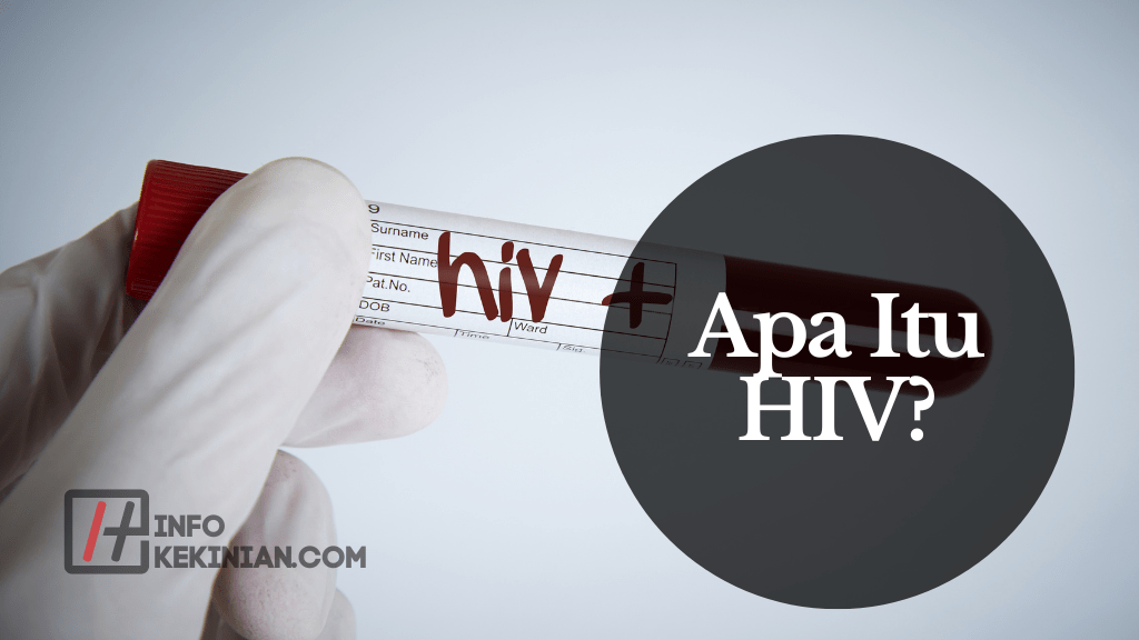 Apa Itu HIV
