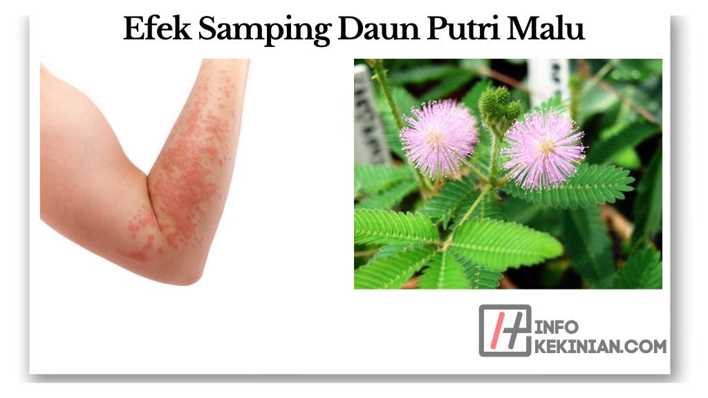 Manfaat Daun Putri Malu Untuk Kesehatan