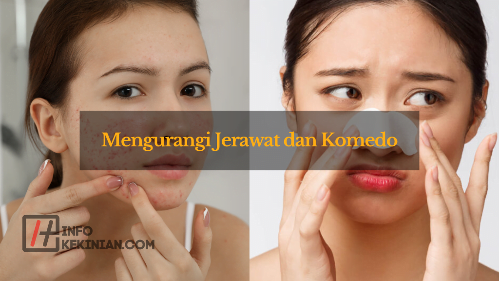 Mengurangi Jerawat dan Komedo