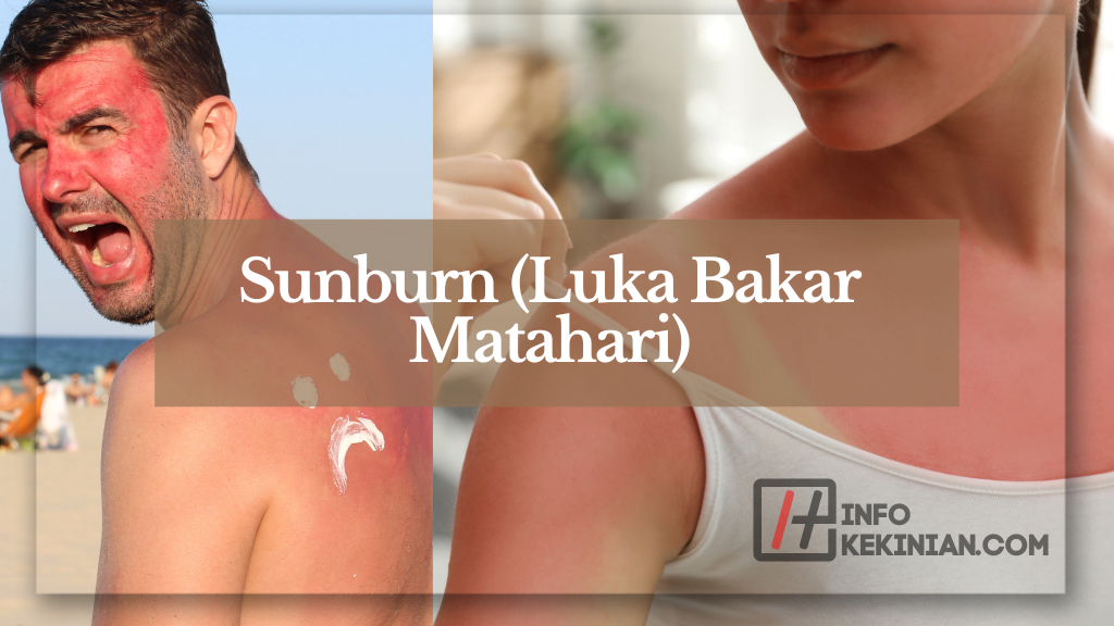 Dampak Sinar Ultraviolet pada Kesehatan