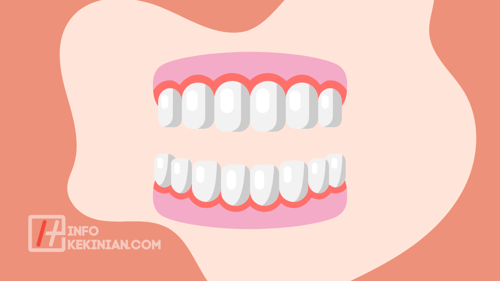 Bahaya Konsumsi Minuman dan Makanan Manis Berlebihan