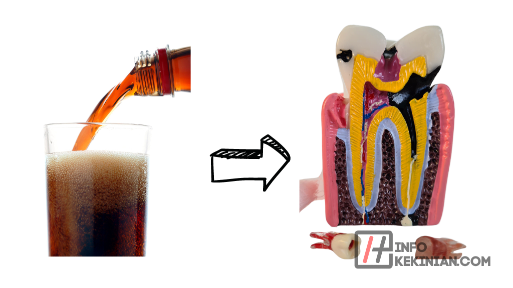 Dampak Minuman Bersoda bagi Kesehatan