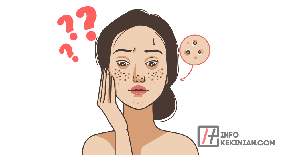 Penyebab Pori-Pori Besar